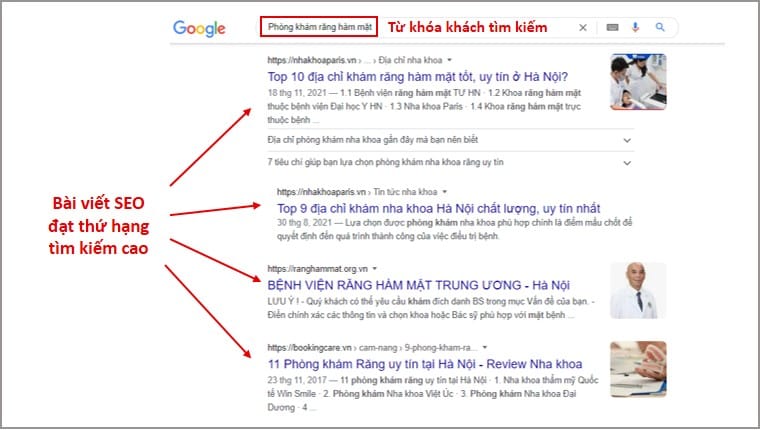 Bài viết quảng cáo Nha khoa được SEO tốt sẽ hiển thị thứ hạng cao. Ngay tại trang tìm kiếm đầu tiên